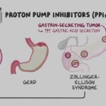 proton pump inhibitors