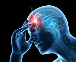 diagnosis and treatment of migrainea