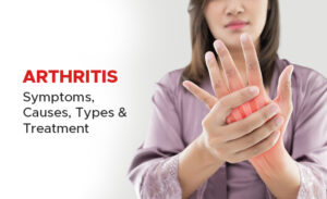 arthritis