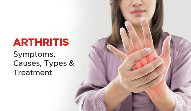 arthritis